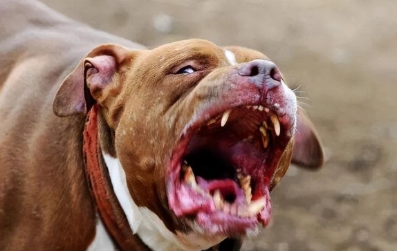 比特犬攻擊預防